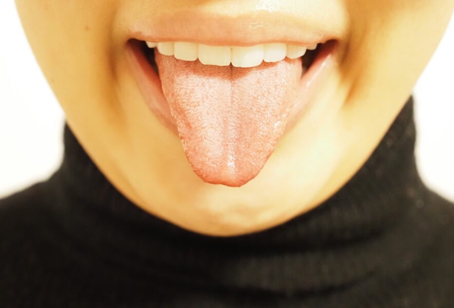 舌が白いのは舌苔のせい？舌苔が増える原因や舌が白くなる他の疾患について解説！
