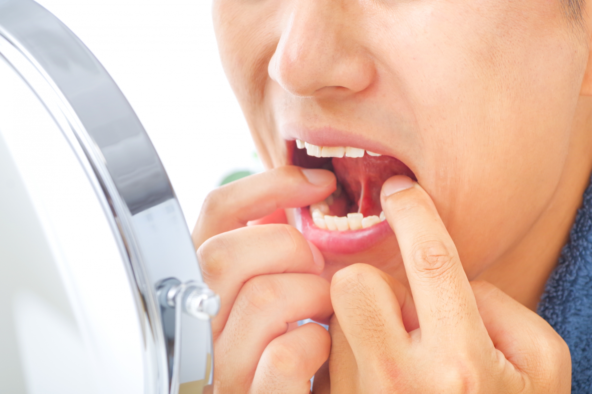 口腔粘膜疾患の治療法