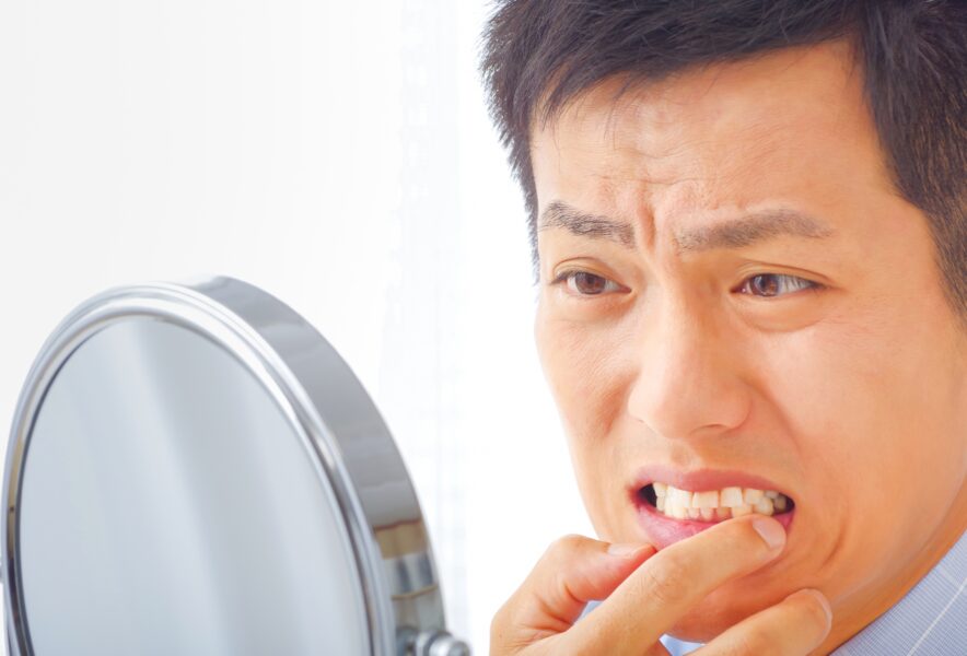 口腔がんは何科を受診するべき？診療科の選び方のポイントや気を付けるべき症状などを解説！