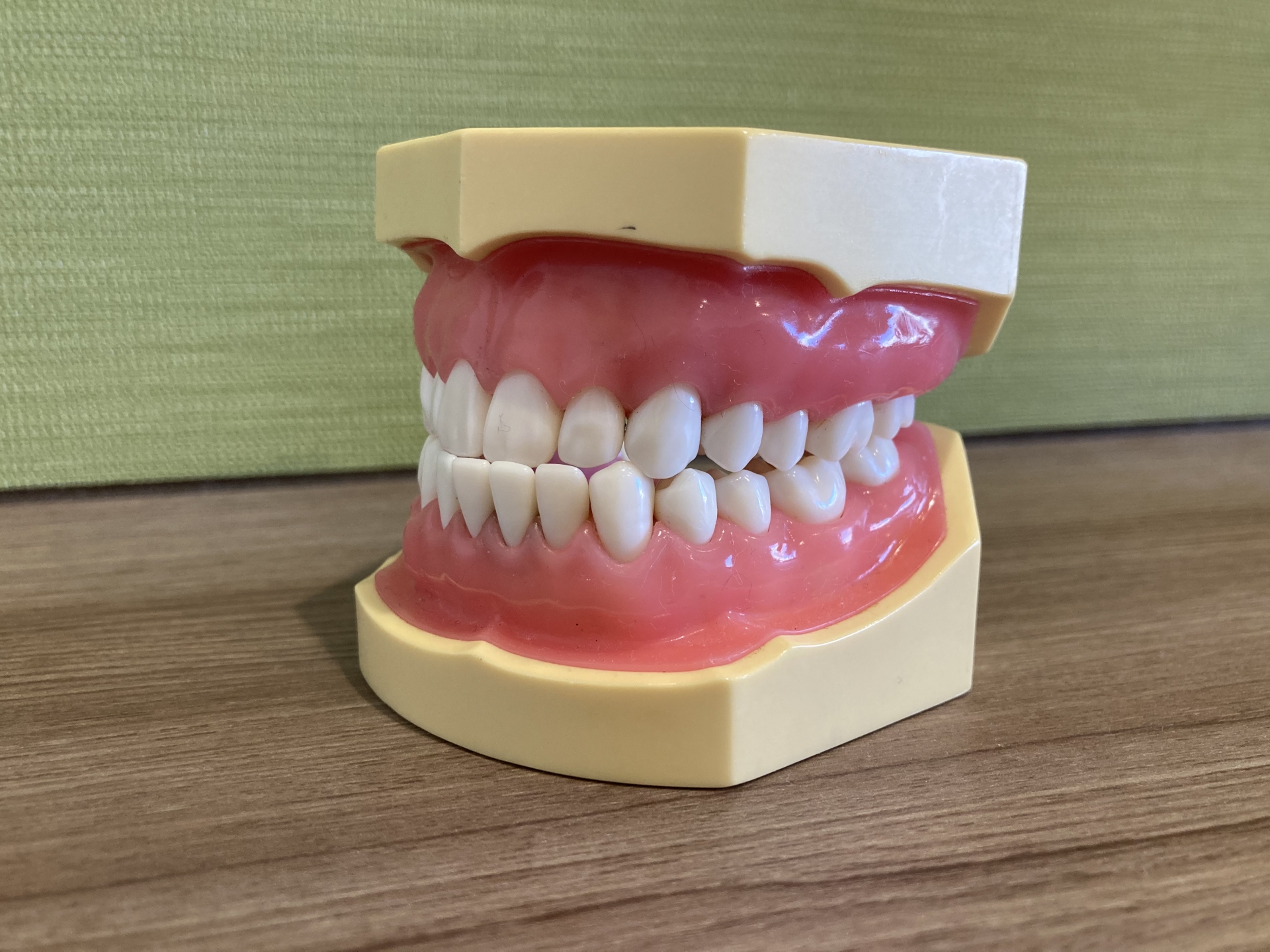 顎変形症のタイプ