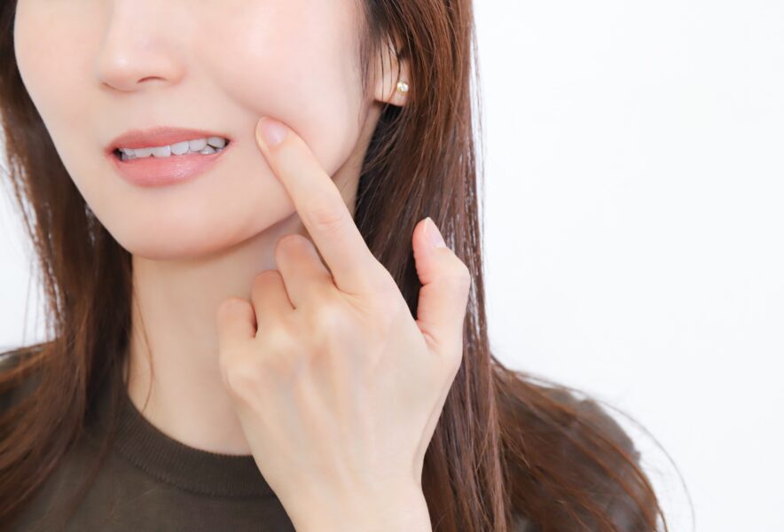 口内炎はどれくらいで治る？口内炎ができる原因や治癒期間、回復を早めるコツを解説
