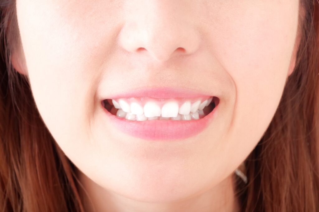 笑顔で歯を強調する若い女性