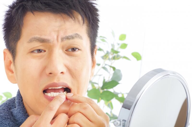 舌がんの症状は?舌がんの原因や口腔がんの種類も紹介します - 口腔外科DOC